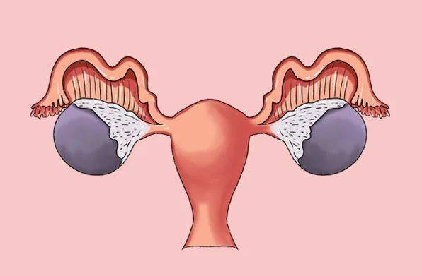 西安生殖保健院不孕不育医院：多囊怎么调理才能怀孕呢?