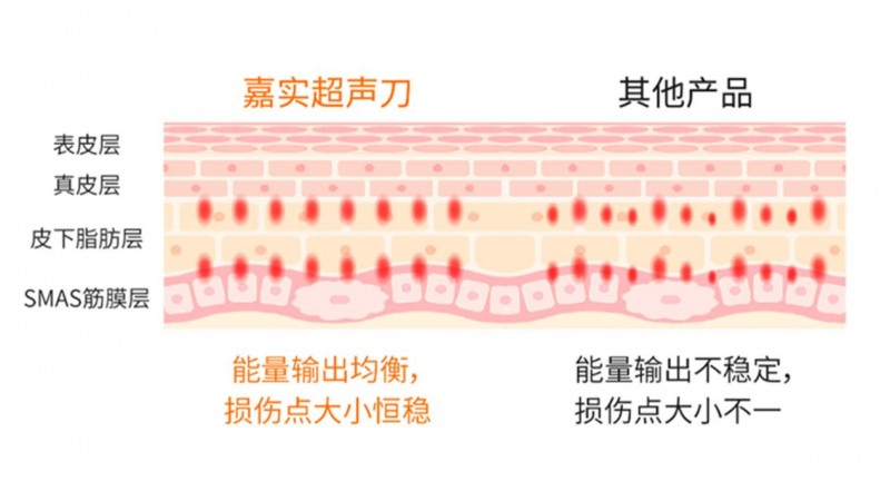 让美更有品质，全新一代嘉实超声刀®重磅发布！