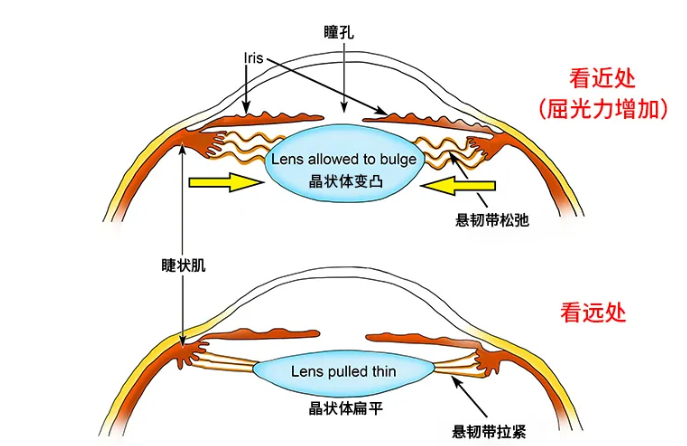 中老年人如何延缓老花眼的出现？上海眼科院长：可以从这几点入手